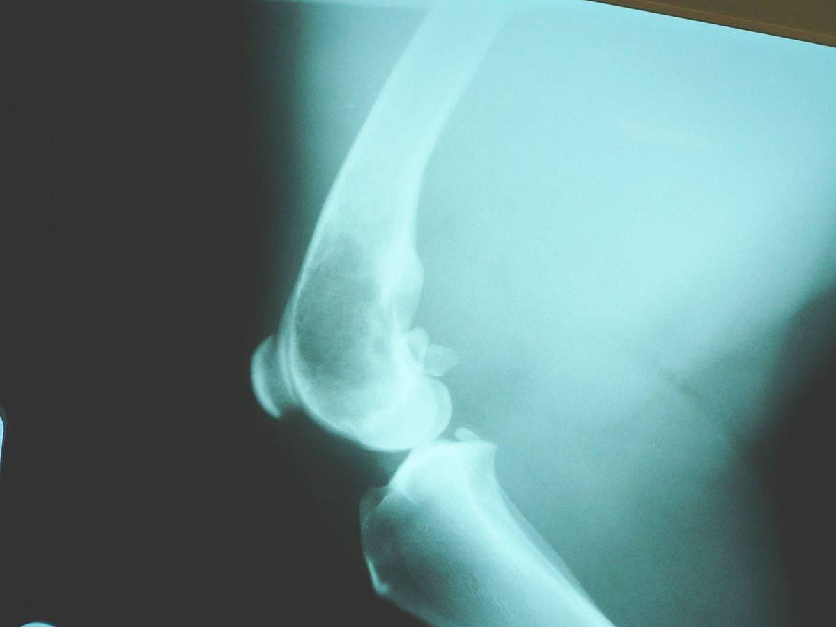 Psí osteosarkom